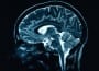 cerebro cerebro